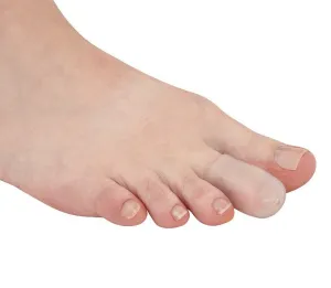 Chaneco Silicone Gel Toe Cup
